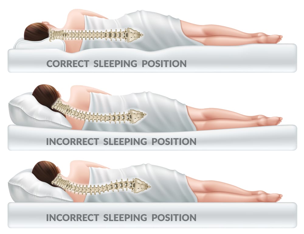 Illustration of using suitable pillow loft and it's affect on spinal alignment
